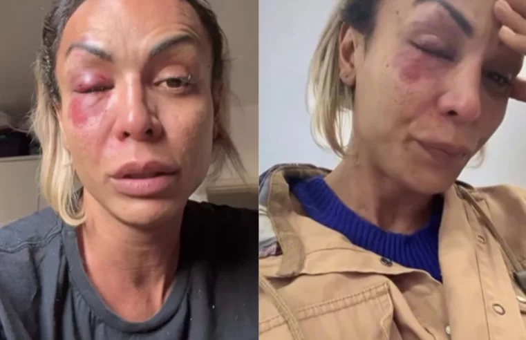 Iza Potter sofre agressão e destaca realidade das mulheres trans