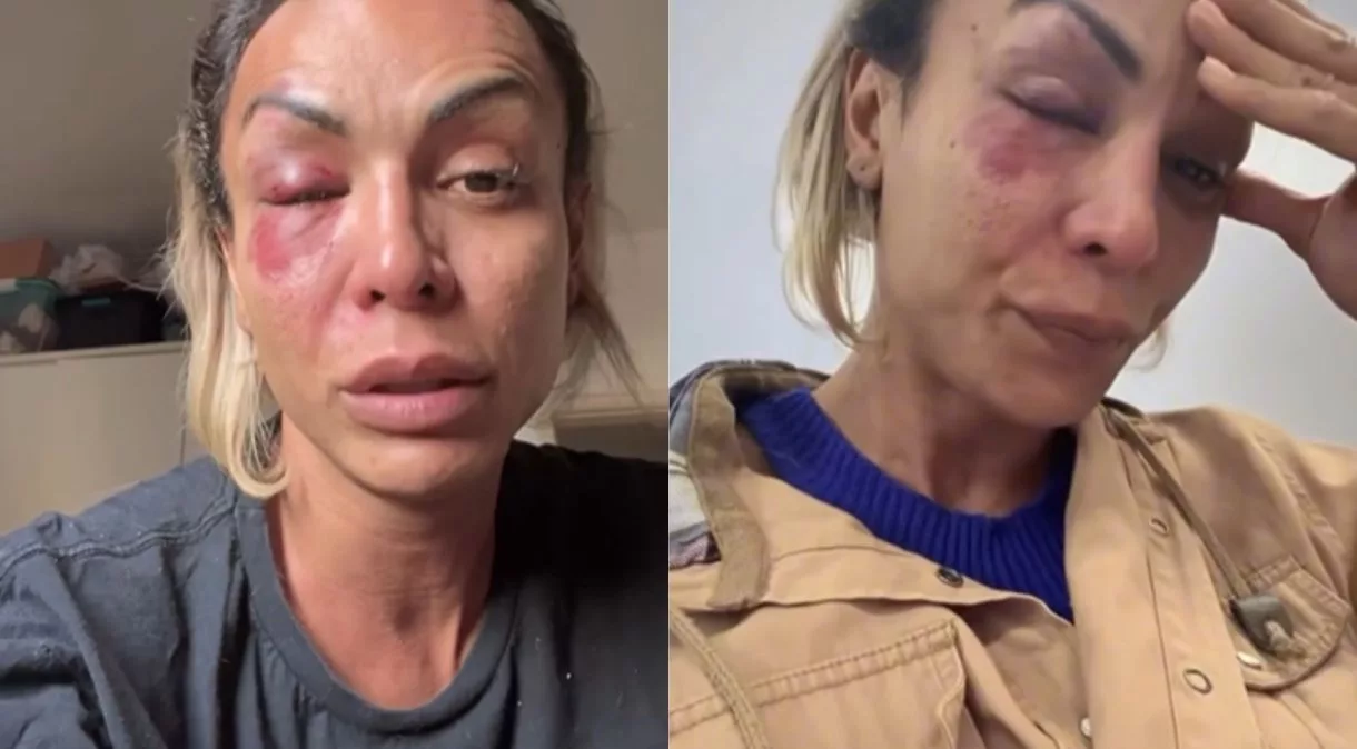 Iza Potter sofre agressão e destaca realidade das mulheres trans